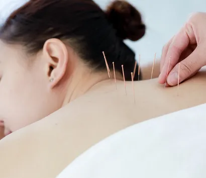 Acupuncture Clinic in Etobicoke: Natural Pain Relief and Whole-Body Balance at Rapharehab