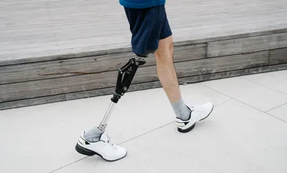 Amputee Rehabilitation