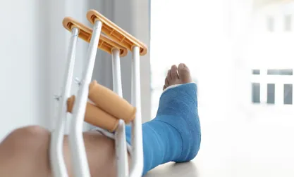 Fracture Rehabilitation