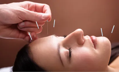 Acupuncture | Rapharehab