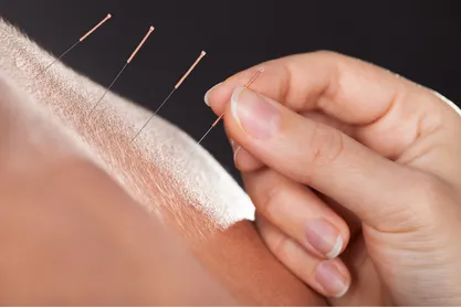 Acupuncture | Rapharehab