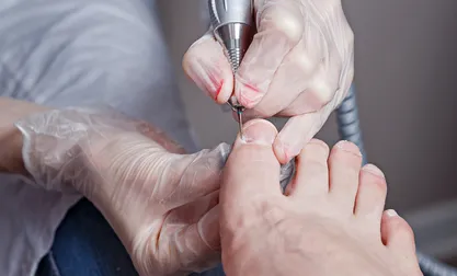Chiropody | Rapharehab