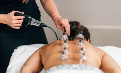 Cupping & Dry Needling | Rapharehab